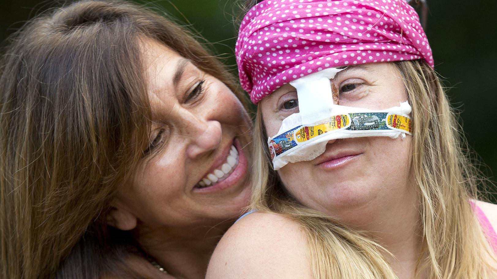 Special Olympian turns to pioneering Tucson surgeon after dog bites her face